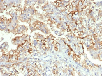 B7-H3 Antibody / CD276