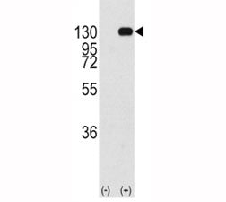 FGFR Antibody
