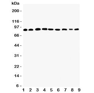 Western blot testing of Plakophilin 2 antibody and Lane 1: rat heart; 2: human placenta; 3: (r) brai