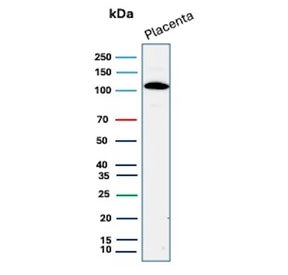 E-Cadherin Antibody / CDH1
