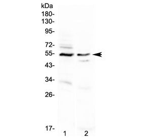 VIPR1 Antibody / VIP Receptor 1
