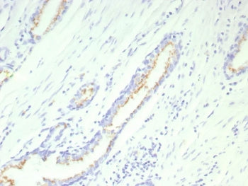 IHC staining of FFPE human prostate tissue with recombinant SLC45A3 antibody (clone SLC45A3/9216R). 