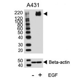 Phospho-ErbB2 Antibody (pY1140)