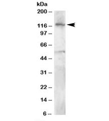 HLTF Antibody