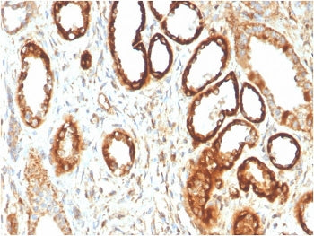 IHC staining of FFPE human kidney with FABP1 antibody. HIER: boil tissue sections in pH 9 10mM Tris 