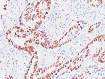 IHC testing of human colon with Retinoblastoma antibody (clone SPM353). Required HIER: boil tissue s