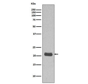 Western blot testing of human MCF7 cell lysate with HRAS antibody. Predicted molecular weight ~21 kD