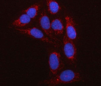 RBFA Antibody / Ribosome-binding factor A / C18orf22