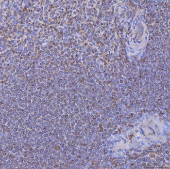 IHC staining of FFPE human spleen tissue with CD74 antibody. HIER: boil tissue sections in pH8 EDTA 