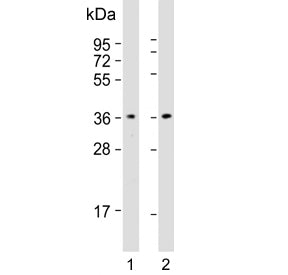 Western blot testing of human 1) A431 and 2) Jurkat cell lysate with CAPZA1 antibody. Predicted mole