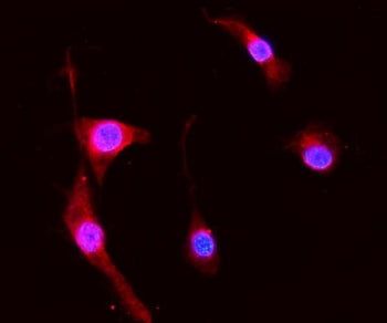 S100A8 Antibody / MRP8