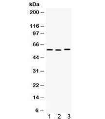 Western blot testing of 1) rat thymus, 2) rat spleen, and 3) human SMMC-7721 lysate with CAP1 antibo