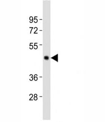 Western blot testing of Caspase-4 antibody at 1:2000 dilution + human Raji lysate; Expected molecula