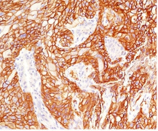 EGF Receptor / EGFR Antibody