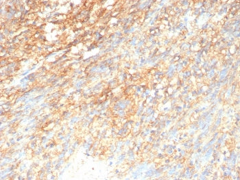 c-Kit Antibody / CD117 / SCFR