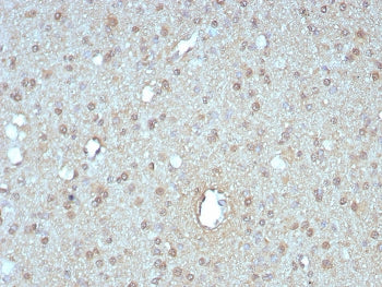 GIRK2 Antibody / KCNJ6