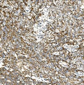 VPS4A Antibody