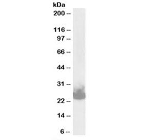 Western blot testing of mouse brain lysate with SNAP25 antibody at 0.03ug/ml. Expected molecular wei