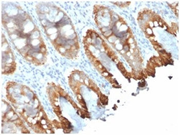Cytokeratin 8/18 Antibody