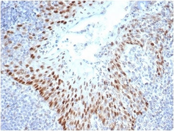IHC staining of FFPE human tonsil tissue with SOX2 antibody (clone SOX2/4267R) at 2ug/ml in PBS for 