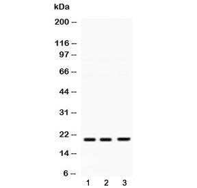 Western blot testing of 1) rat brain, 2) mouse brain and 3) human A549 lysate with HRAS antibody at 