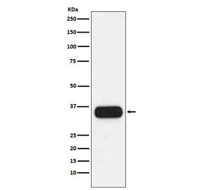 HLA-DQA1 Antibody