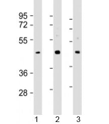Western blot testing of human 1) HepG2, 2) MCF-7 and 3) PC-3 cell lysate with SAPCD2 antibody at 1:2