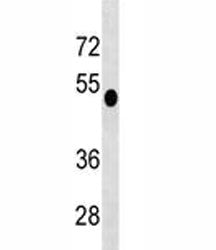 DUSP6 Antibody