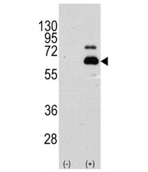 p70 S6 Kinase alpha Antibody (RPS6KB1)