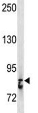 STAT3 Antibody