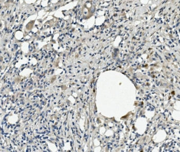 Kallistatin Antibody / SERPINA4