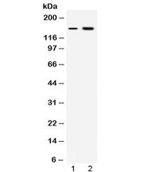 Insulin Receptor Antibody / INSR