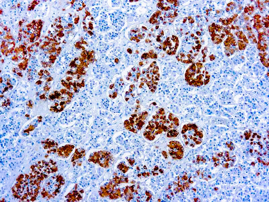 Adrenocorticotropic Hormone (ACTH) - (AH26)