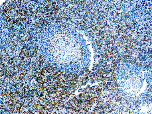 CD43 T-Cell