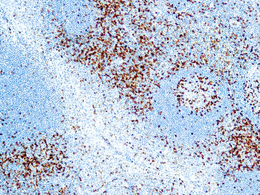 CD45 RO T-Cell