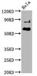 Phospho-AKT1 (T450) Antibody