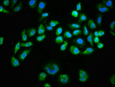 Phospho-AKT1 (Ser473) Antibody