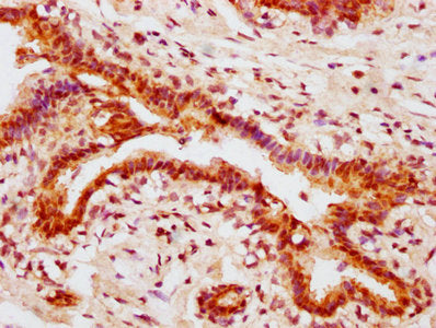 Phospho-AKT1 (Ser473) Antibody