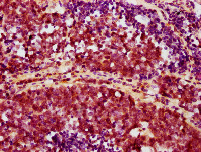 Phospho-AKT1 (Ser473) Antibody