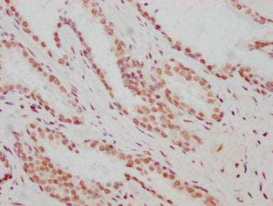 ARNT Antibody