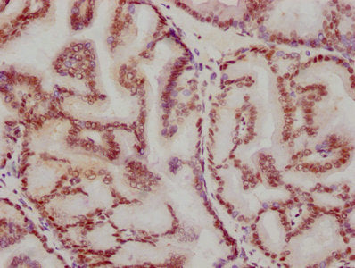 ATF2 Antibody