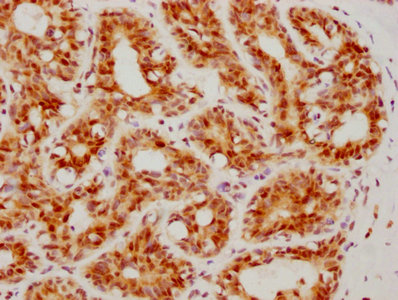 ATF4 Antibody