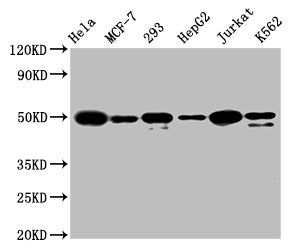ATF4 Recombinant Monoclonal Antibody