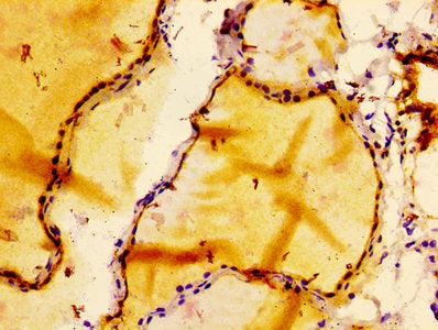 BCL2 Antibody