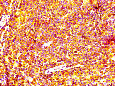 BCL2 Antibody