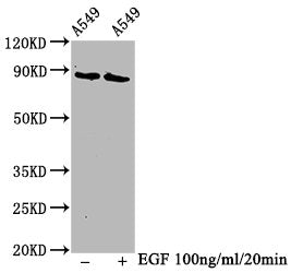 Phospho-BRAF (T401) Recombinant Monoclonal Antibody