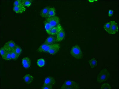 CCR9 Antibody