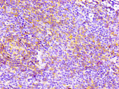 CD4 Antibody