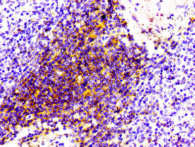 CD4 Antibody