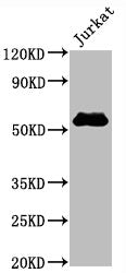 CD4 Antibody